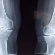 shibarium-network-lull-–-how-it-affects-the-future-of-bone